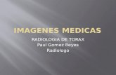 RADIOLOGIA DE TORAX Paul Gomez Reyes Radiologo.  IMAGEN CARDIACA DIAGNOSIS SEVERIDAD DE LA ENFERMEDAD COMPLICACION SUGERIR TX ADECUADO.
