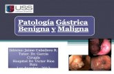 Patología Gástrica Benigna y Maligna Interno: Jaime Caballero R. Tutor: Dr. García Cirugía Hospital Dr. Víctor Ríos Ruiz Los Ángeles - 2012.