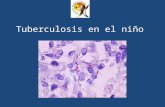 Tuberculosis en el niño. ¡AUN TENEMOS TUBERCULOSIS EN CHILE! Cada semana mueren 5 chilenos por Tuberculosis (+/- 200 a 300 al año) Cada día enferman 7.