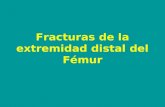 Fracturas de la extremidad distal del Fémur. Clasificación de las fracturas de la extremidad distal del fémur Supracondíleas : 45% Supra e intercondíleas.