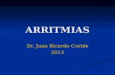 ARRITMIAS Dr. Juan Ricardo Cortés 2013. Extrasístoles Ventriculares y TV No Sostenida Son dos tipos de arritmias ventriculares frecuentes Son dos tipos.