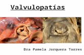Valvulopatías Dra Pamela Jorquera Torres.  Válvulas cardíacas.