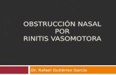 OBSTRUCCIÓN NASAL POR RINITIS VASOMOTORA Dr. Rafael Gutiérrez García.