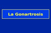 La Gonartrosis. Gonartrosis estática 1 sujeto sobre 100 entre 55 y 64 años 2 % de hombres 6,6 % de mujeres entre 65 y 75 años.