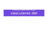 Alteraciones vasculares del pulmon. Dr. Edgar F. Hernández Paz 1-Embolia pulmonar. Obstrucción de la arteria pulmonar o una de sus ramas por material.