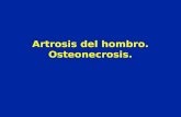 Artrosis del hombro. Osteonecrosis.. Artrosis Centrada.