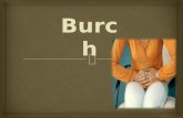 Burch la técnica de Burch es actualmente reconocida como una de las más efectivas para el tratamiento de la incontinencia urinaria de esfuerzo. Es una.