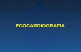 ECOCARDIOGRAFIA. Preguntas ¿ Qué es un ecocardiograma?¿ Qué es un ecocardiograma? ¿ Modalidades del ecocardiograma?¿ Modalidades del ecocardiograma? ¿