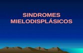 SINDROMES MIELODISPLÁSICOS. Los síndromes mielodisplásicos constituyen un conjunto de enfermedades que se caracterizan por:  Una hematopoyesis en medula.