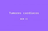 Tumores cardíacos BCM II. Tumores cardíacos Son extremadamente raros; no más del 0,1% del total de hallazgos de autopsias. El más frecuente en el adulto(50%)