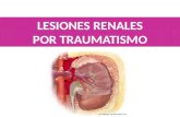Generalidades Comùn Protecciòn renal Fracturas costales y vertebrales transversas 1er.lugar de muerte entre 1-37 años 10% de los politraumatizados tienen.