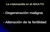 La criptorquidia en el ADULTO - Degeneración maligna - Alteración de la fertilidad.