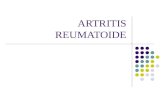 ARTRITIS REUMATOIDE. ARTRITIS REUMATOIDE (AR) Enfermedad inflamatoria cr³nica recurrente y sist©mica, lesiona las articulaciones Se caracteriza por