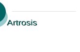 Artrosis. Artrosis (osteoartritis o enf. Articular degenerativa)  Enfermedad no inflamatoria de grandes articulaciones y columna.  Cursa con degeneración.