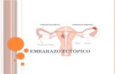 E MBARAZO E CTÓPICO. D EFINICIÓN Embarazo ectópico Embarazo ectópico Se produce cuando el ovulo fertilizado se implanta en un tejido distinto al endometrio.