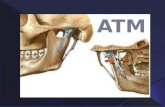 Forma parte del sistema masticatorio.  El área del cóndilo mandibular que se relaciona con el cráneo, se conoce con el nombre de ATM.  Desde el punto.