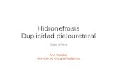 Hidronefrosis Duplicidad pieloureteral Caso clínico Ana Catalán Servicio de Cirugía Pediátrica.