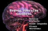 Evento Vascular Cerebral