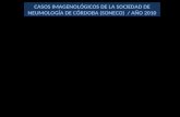 CASOS IMAGENOLÓGICOS DE LA SOCIEDAD DE NEUMOLOGÍA DE CÓRDOBA (SONECO)  / AÑO 2010