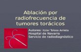 Ablación por radiofrecuencia de tumores torácicos