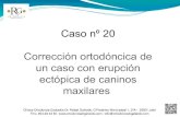 20.- Corrección ortodóncica de un caso con erupción ectópica de caninos maxilares - Rafael Galla