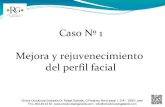 1.- Mejora y rejuvenecimiento del perfil facial - Dr.Gallardo Galdón