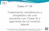 19.- Tratamiento ortodóncico y ortopédico de una paciente con Clase III y agenesia de un incisivo