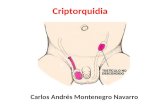 Criptorquidia - Carlos M.
