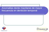 Anomalias Dentoalveolares - Dentición Mixta