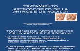 Tratamiento Artroscopico de La Artrosis de Rodilla y Lesiones Condrales