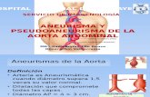 Aneurisma y Pseudoaneurisma de La Aorta Abdominal Final
