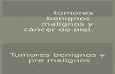 Tumores Benignos Malignos y Cáncer de Piel