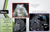 Anatomía Ecográfica Fetal