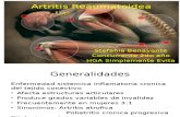 Artritis Reaumatoidea