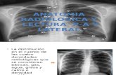 Anatomia Radiologica y Lectura de P-A y Lateral