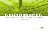 Neuroimagen en las demencias.pdf