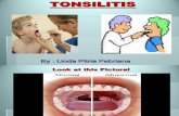 My Presentation_ Tonsilitis
