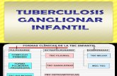 Tuberculosis Ganglionar Infantil