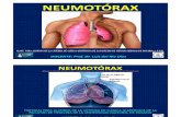 Clase Para Los Alumnos de Clinica Quirurgica Neumotorax Prof. Dr. Luis Del Rio Diez 2012