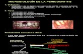 Microbiología de la Periodontitis