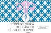 Clasificación histopatológica del cáncer cérvicouterino gilr6