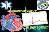 Ekg Eletrocardiograma
