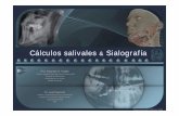 Cálculos salivales & Sialografía Cálculos salivales & Sialografía