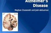 Alzheimer's Disease Presentation