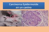 Carcinoma epidermoide can dulce