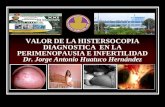 Histeroscopia diagnòstica