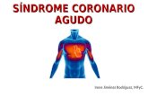 Síndrome Coronario Agudo (SCA)