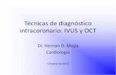 IVUS y OCT: Técnicas de Diagnóstico Intracoronario