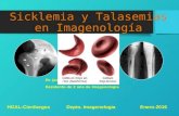 Sicklemia y talasemias en imagenología