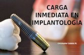Carga inmediata en implantes